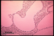 Microstructure