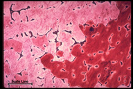 Microstructure