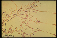 Microstructure